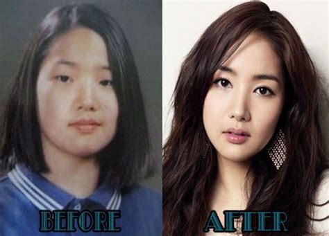 kim lee before plastic surgery.